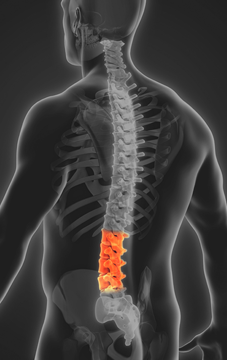 Spine Lumbar