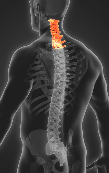 Spine Cervical